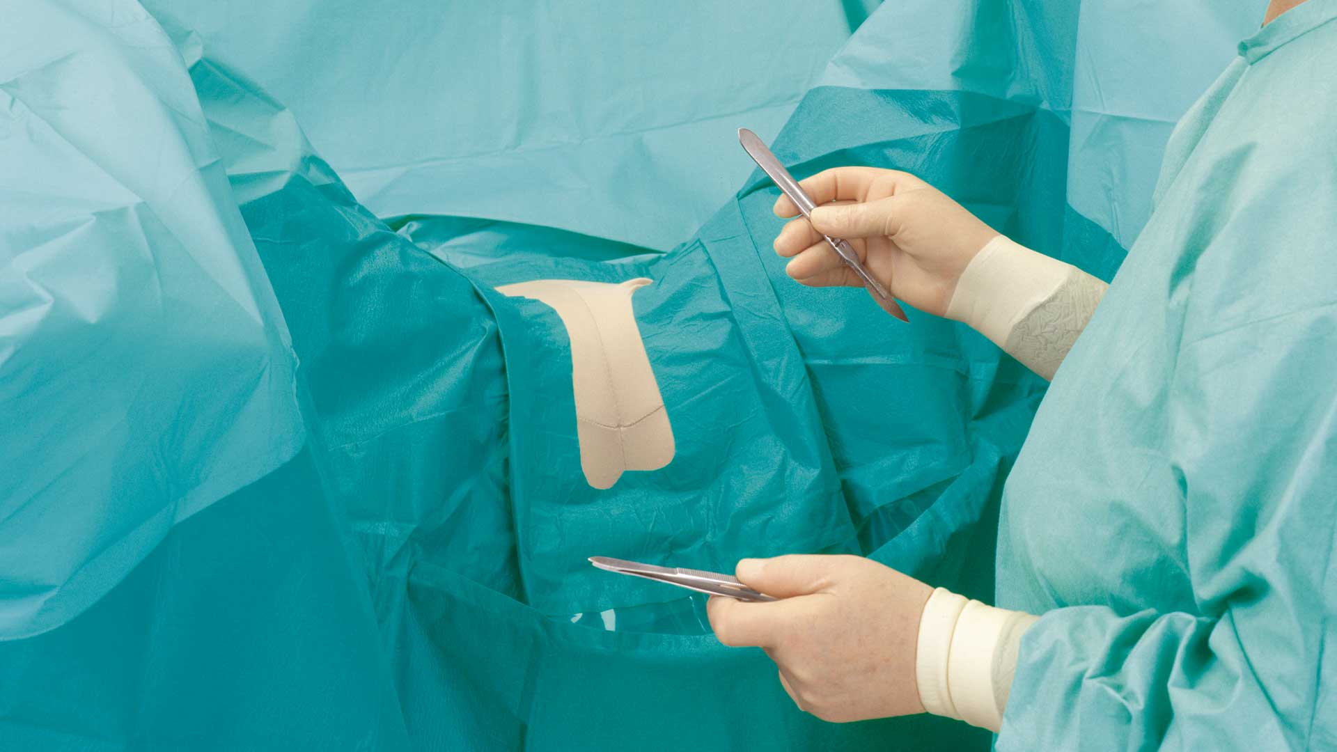 een chirurg gebruikt een BARRIER gynaecologie afdeklaken tijdens een operatie